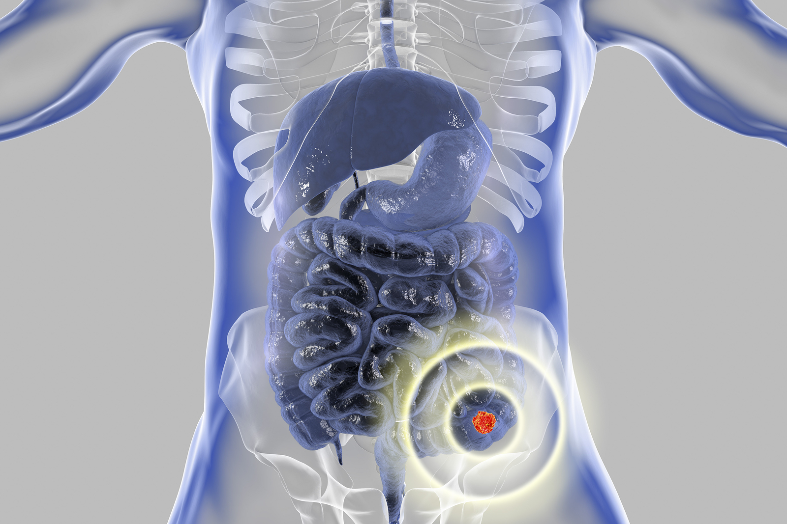 Isotopes are used everyday in medical imaging