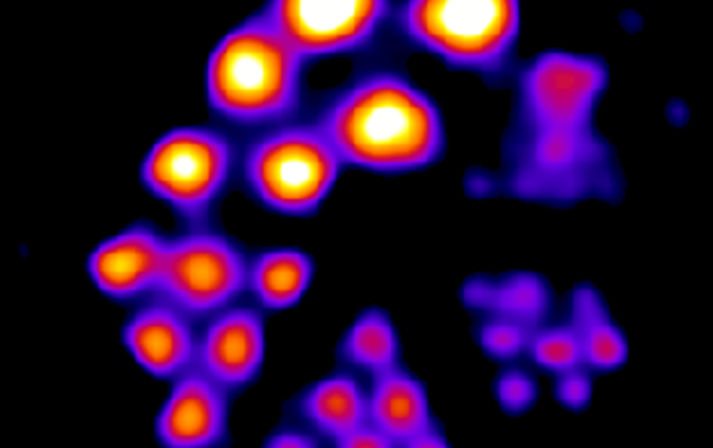 SPECT image of 0.8 mCi of Pb-203 as PbCl2 in solution.  The material was placed in a small device used to gauge resolution capabilities of the imaging camera against the source isotope. Image courtesy: Suzanne E. Lapi and Shefali Saini, UAB